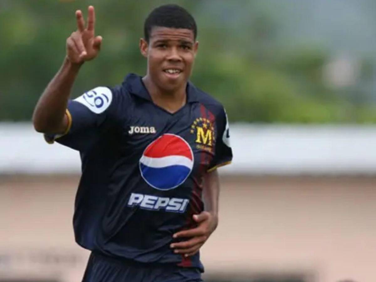 Así es la nueva vida de Shannon Welcome en EE UU: ¿Qué le pasó en su boca?