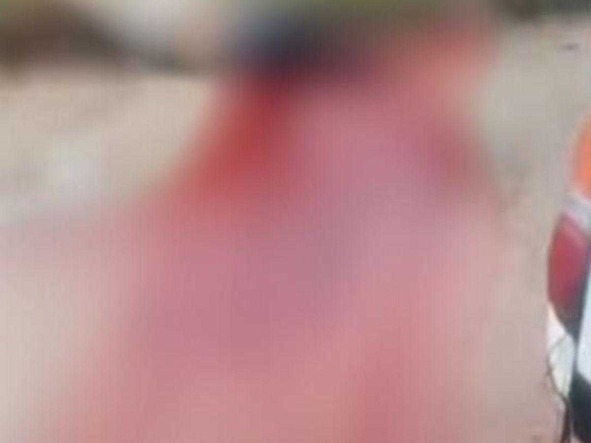 Un cable cruzado en la vía lo decapitó de inmediato: Así fue el accidente donde murió Jimmy Molina