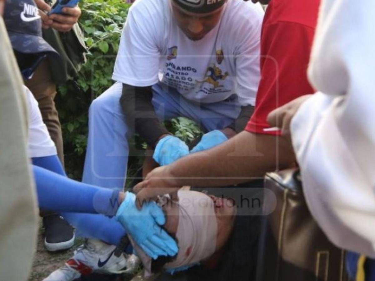 ¿Quién es el estudiante de la UNAH que perdió un ojo durante protesta en el Congreso?
