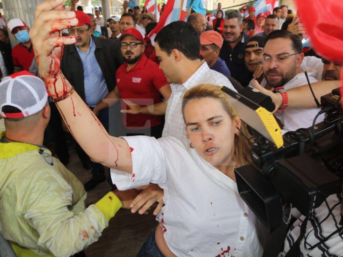 En fotos: así fue la agresión de policías y seguridad privada hacia liberales en el Congreso