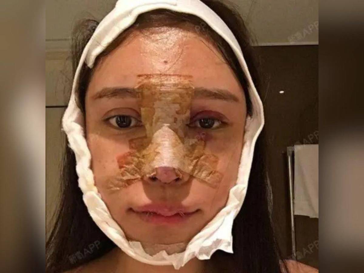 Abby Wu, la mujer que se ha hecho más de 100 cirugías: Nunca dejaré de hacérmelas