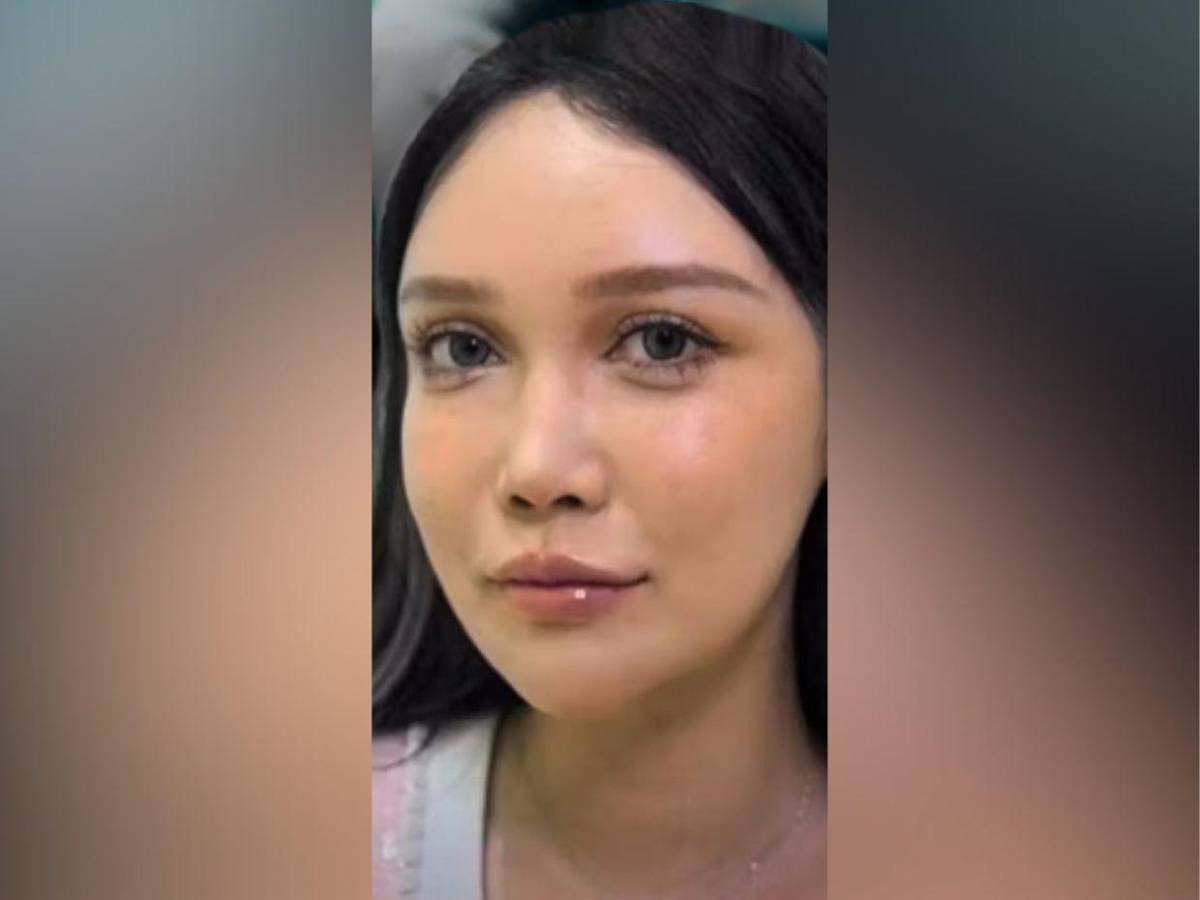 Abby Wu, la mujer que se ha hecho más de 100 cirugías: Nunca dejaré de hacérmelas