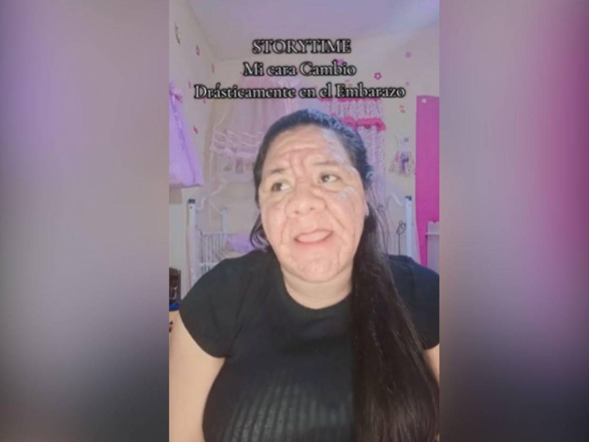 Joven con 8 meses de embarazo enfrenta deformación facial tras error médico