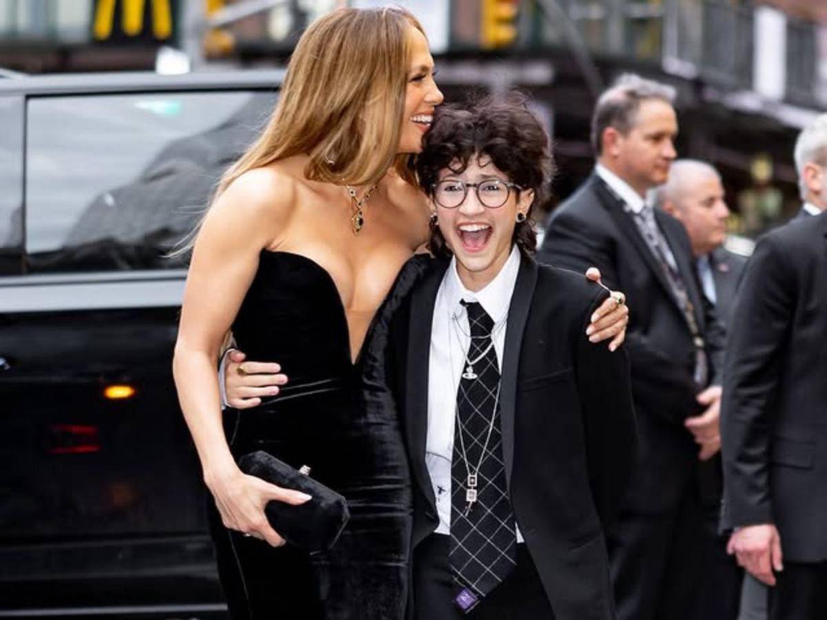 Jennifer López sufre lesión en el rostro tras un accidente en escenario