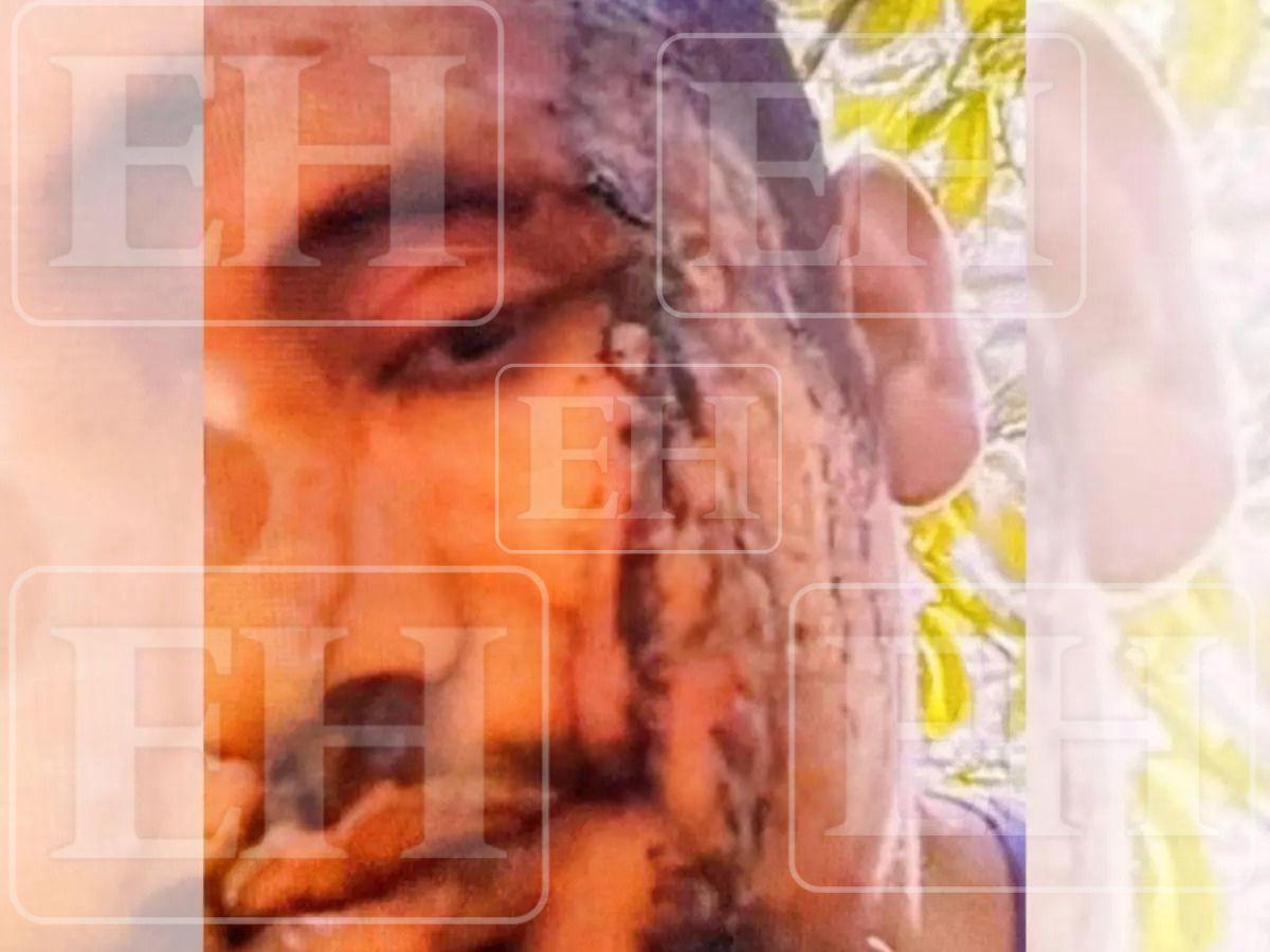 Su rostro ensangrentado: revelan fotografía de Esteban Ferrera, del “Cártel del Diablo”, herido