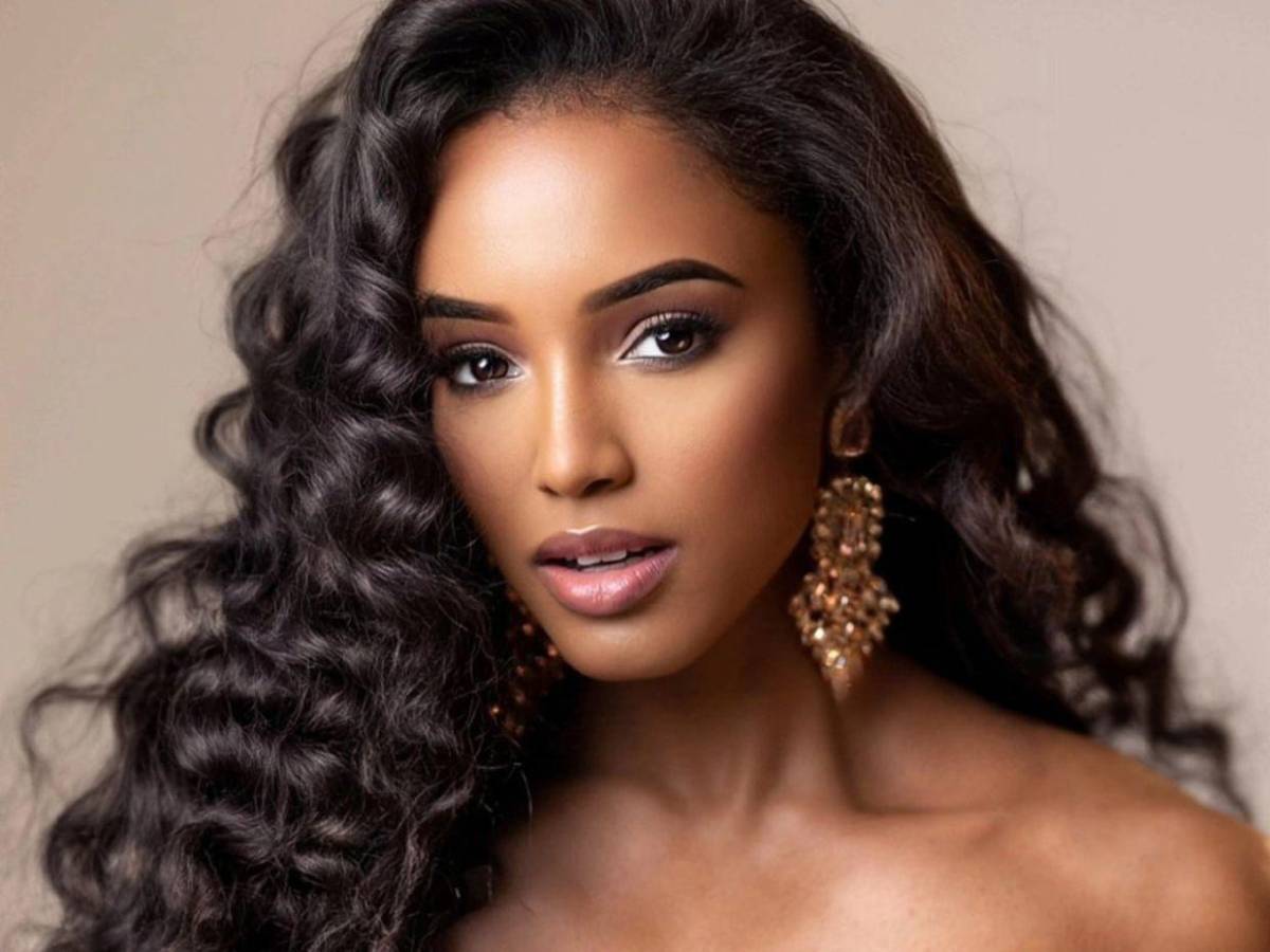 Miss Jamaica: Su estado empeora tras caída en Miss Universo 2025