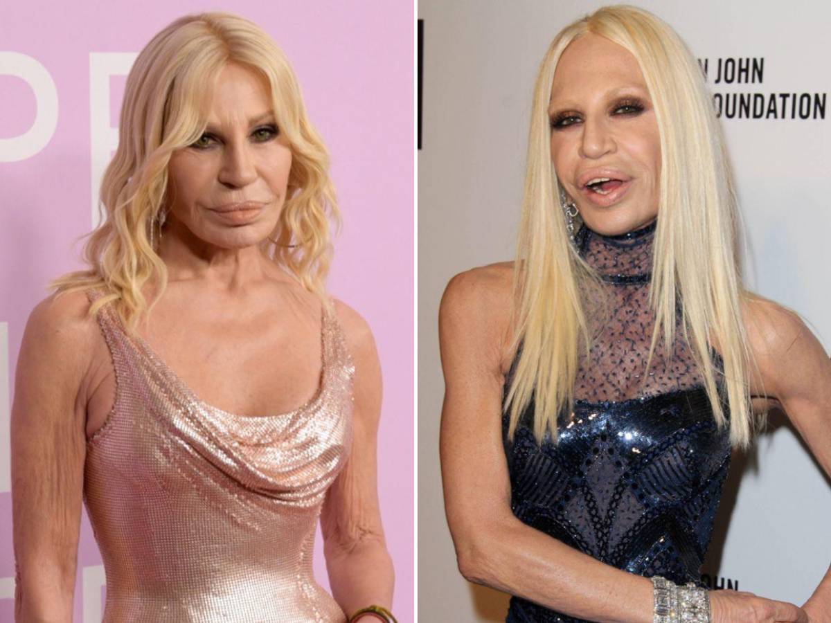 ¿Qué cambios ha hecho Donatella Versace en su rostro? Esto dicen los expertos