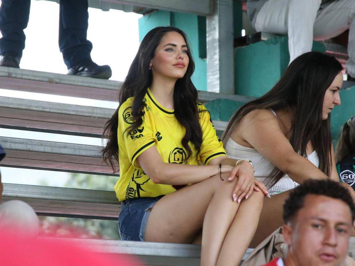 Más que belleza: Haley Amaya, la modelo hondureña que sorprendió a futuras madres en un hospital