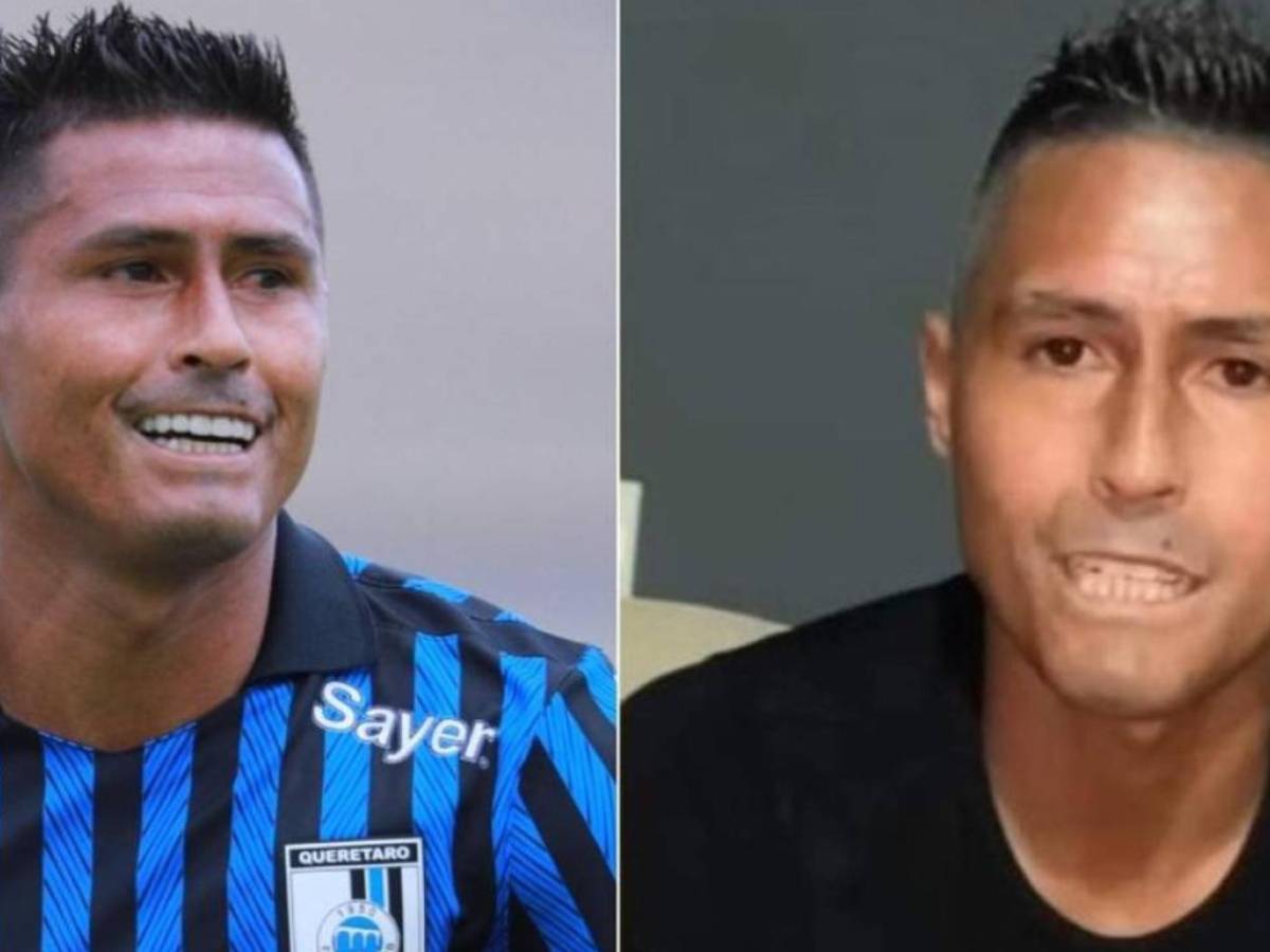 Osvaldo Martínez: ¿Qué enfermedad sufre y cuáles son sus consecuencias?