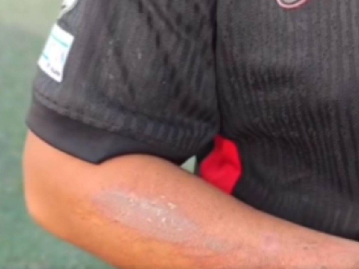 Ricardo García, el pequeño de 2 años que murió tras incendio en Ocotepeque