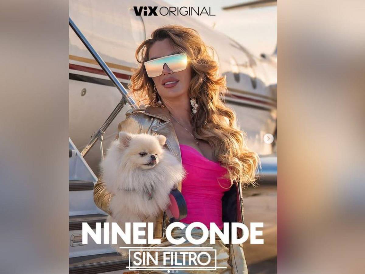 Sin filtro: Así habla Ninel Conde sobre la polémica de las cirugías