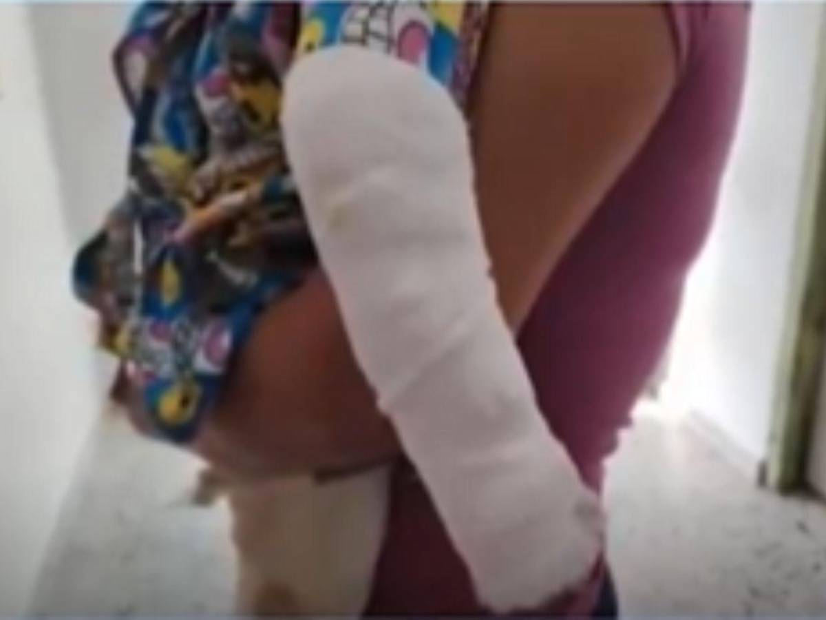 Él me lo quemó, por celos, denuncia madre de menor agredido por su pareja