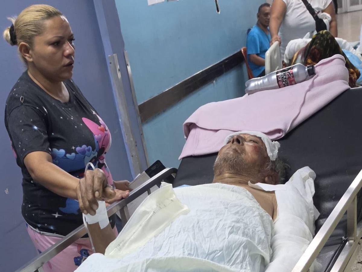 Incendio en barrio San Martín deja cuatro quemados; entre ellos dos adultos mayores