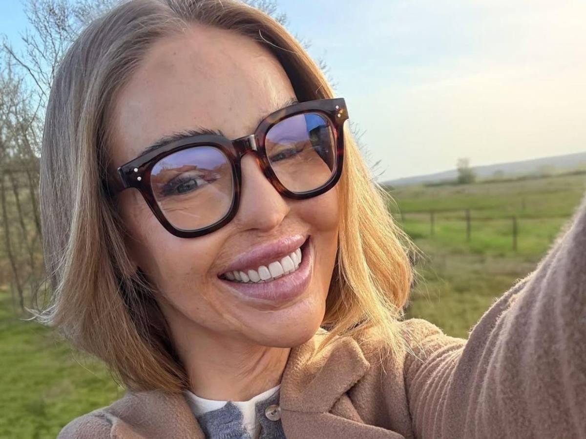 ¿Qué ha sido de Katie Piper, la presentadora a la que le tiraron ácido en la cara?