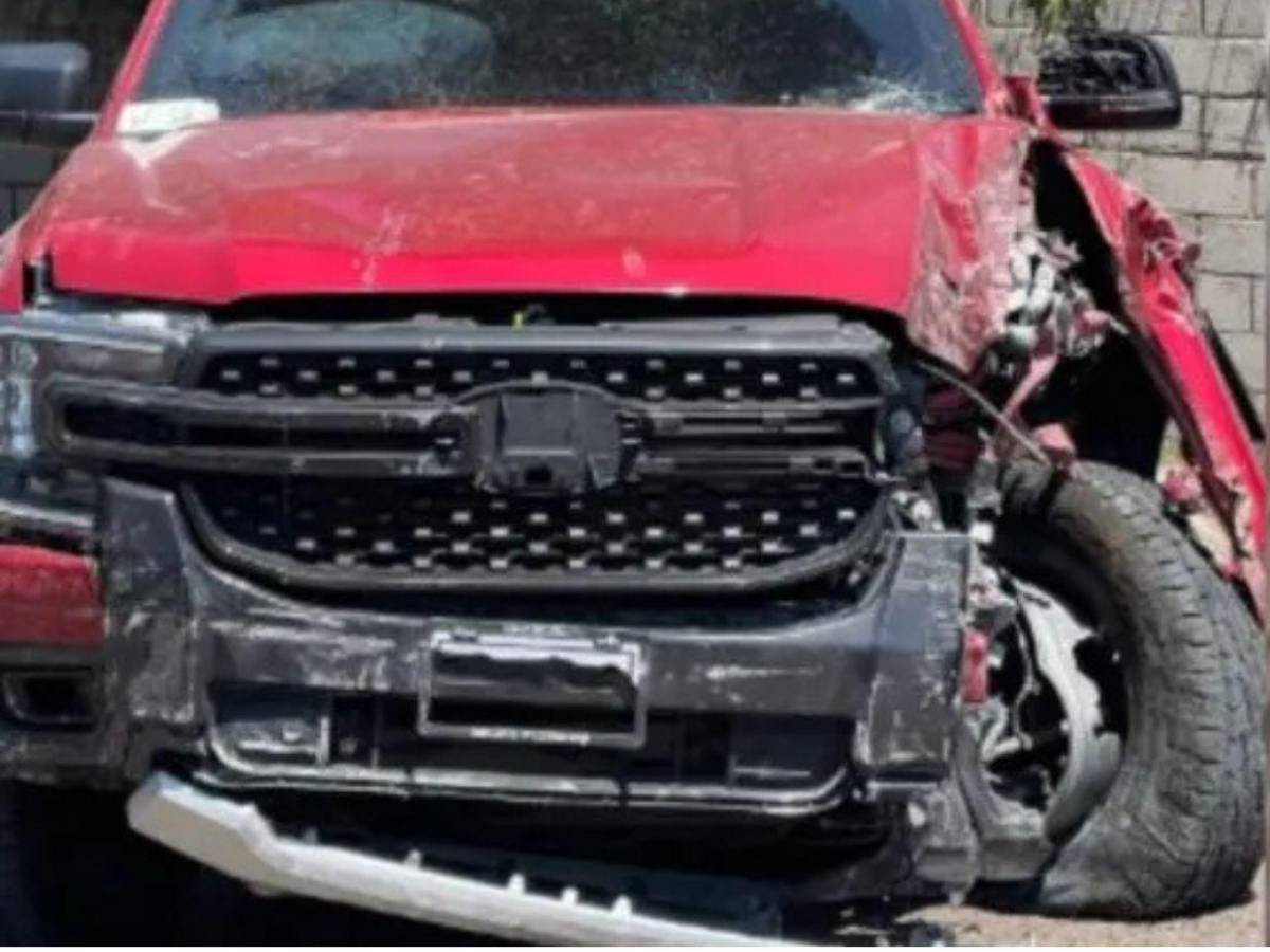 Saraí Espinal reaparece con collarín y moretones tras grave accidente vial