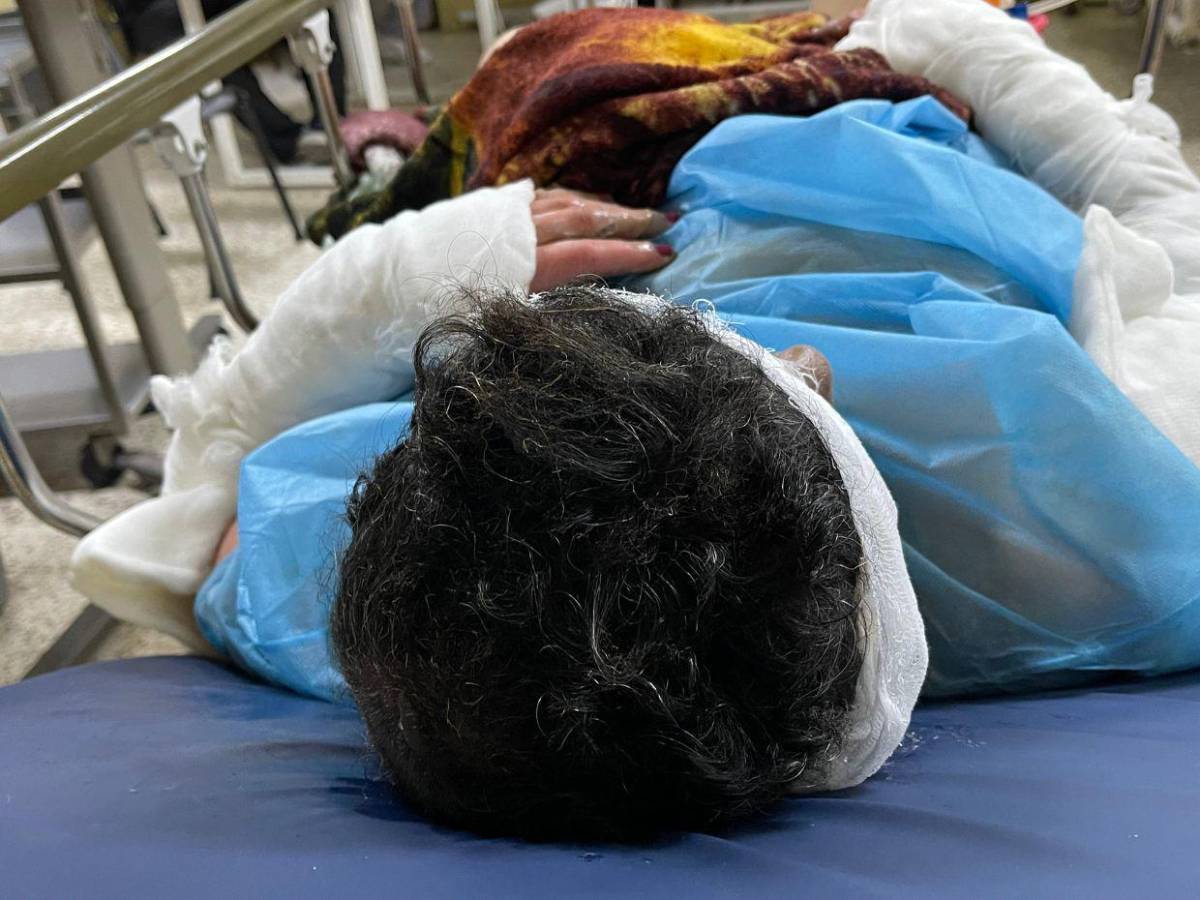 Adultos mayores sufren quemaduras tras incendio que arrasó con seis viviendas en barrio San Martín