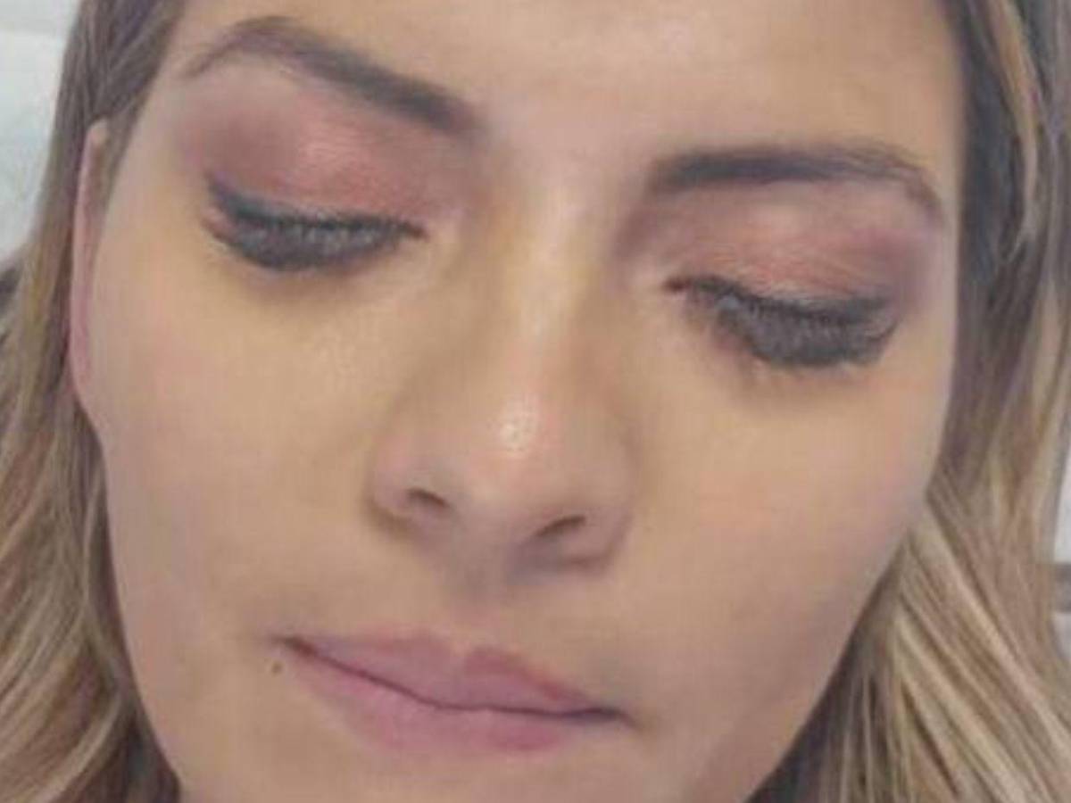 Saraí Espinal reaparece con collarín y moretones tras grave accidente vial