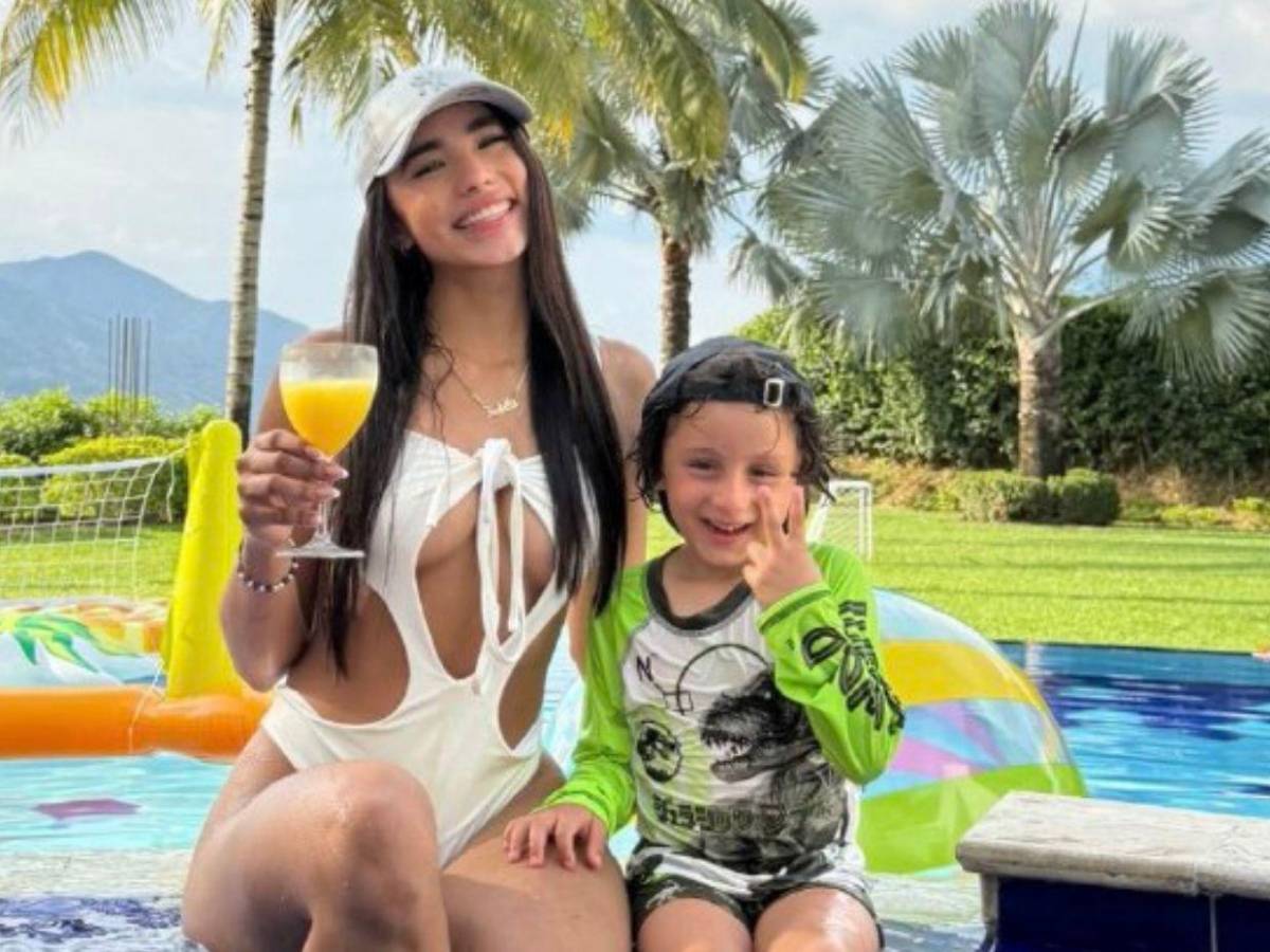 El antes y el después de la modelo Karina García: su transformación total