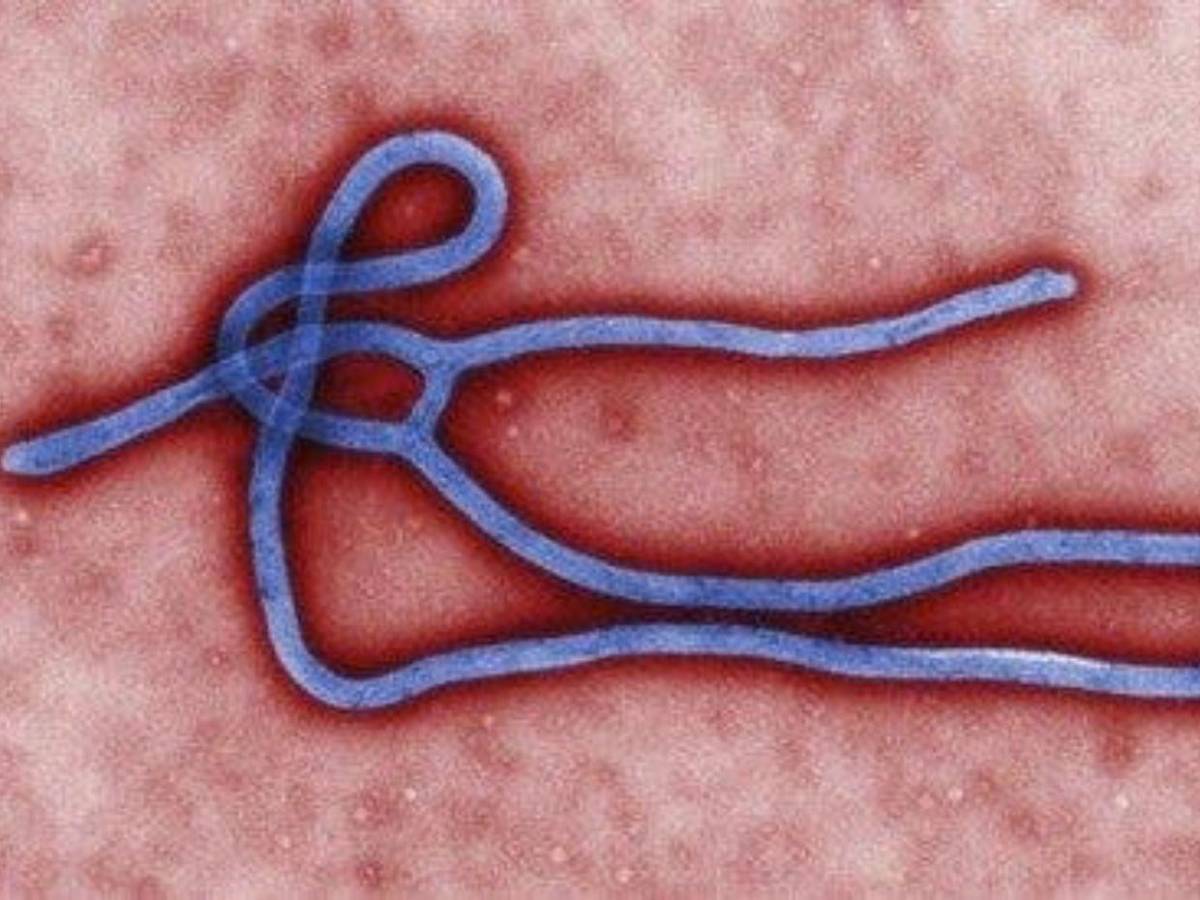 Ébola y sus síntomas: todo sobre la enfermedad que alerta a la OMS