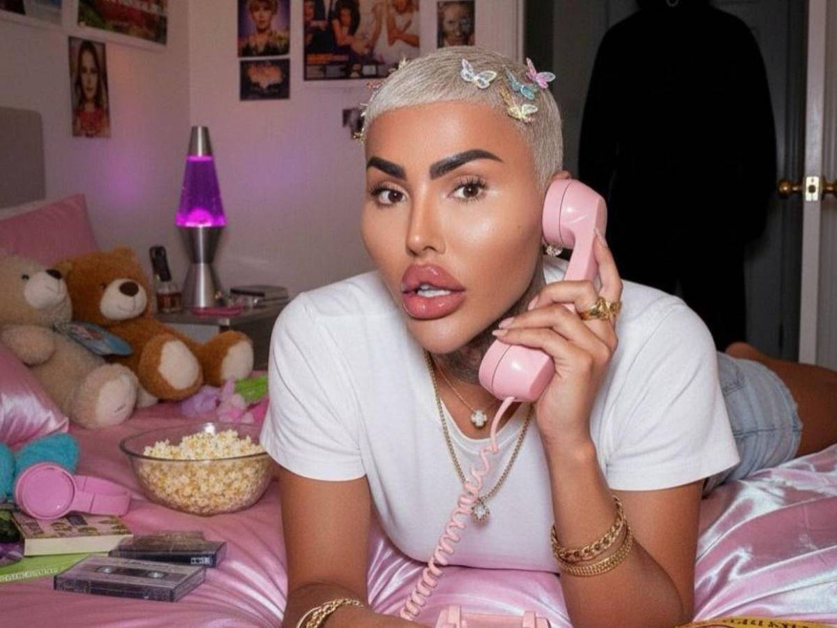 Muere el rey de los labios tras presuntas complicaciones por cirugía estética