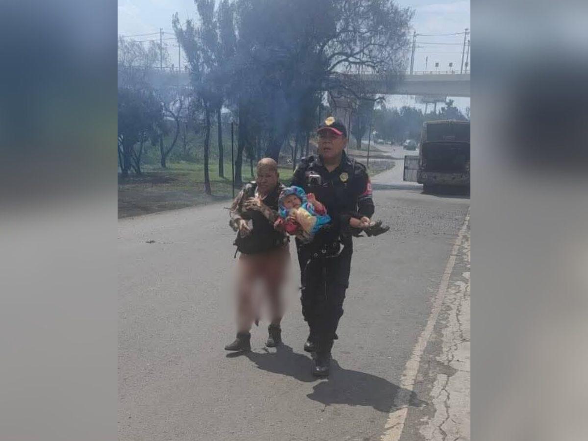 Abuela se quemó el 90% del cuerpo al salvar a su nieta en explosión en CDMX