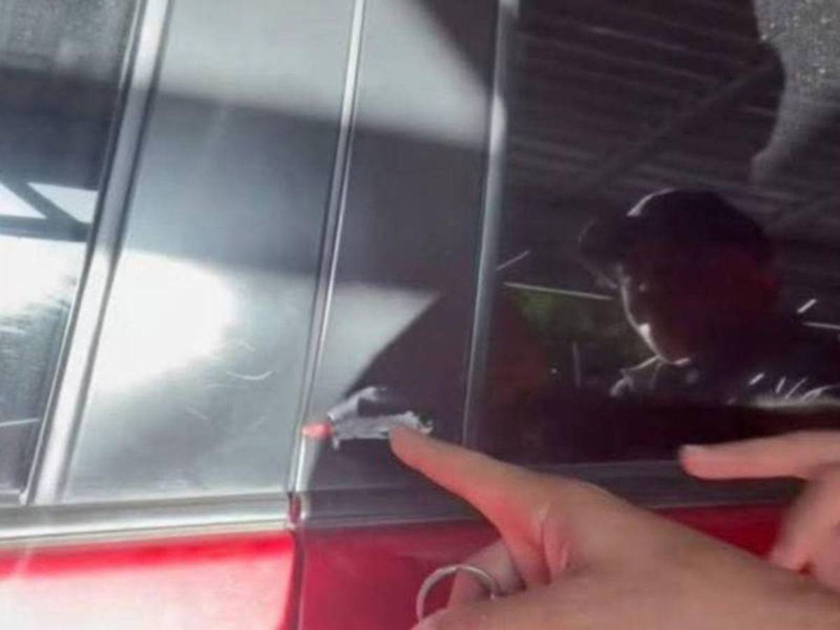 ¿Dónde impactaron las balas en el atentado contra el alcalde de Olanchito?