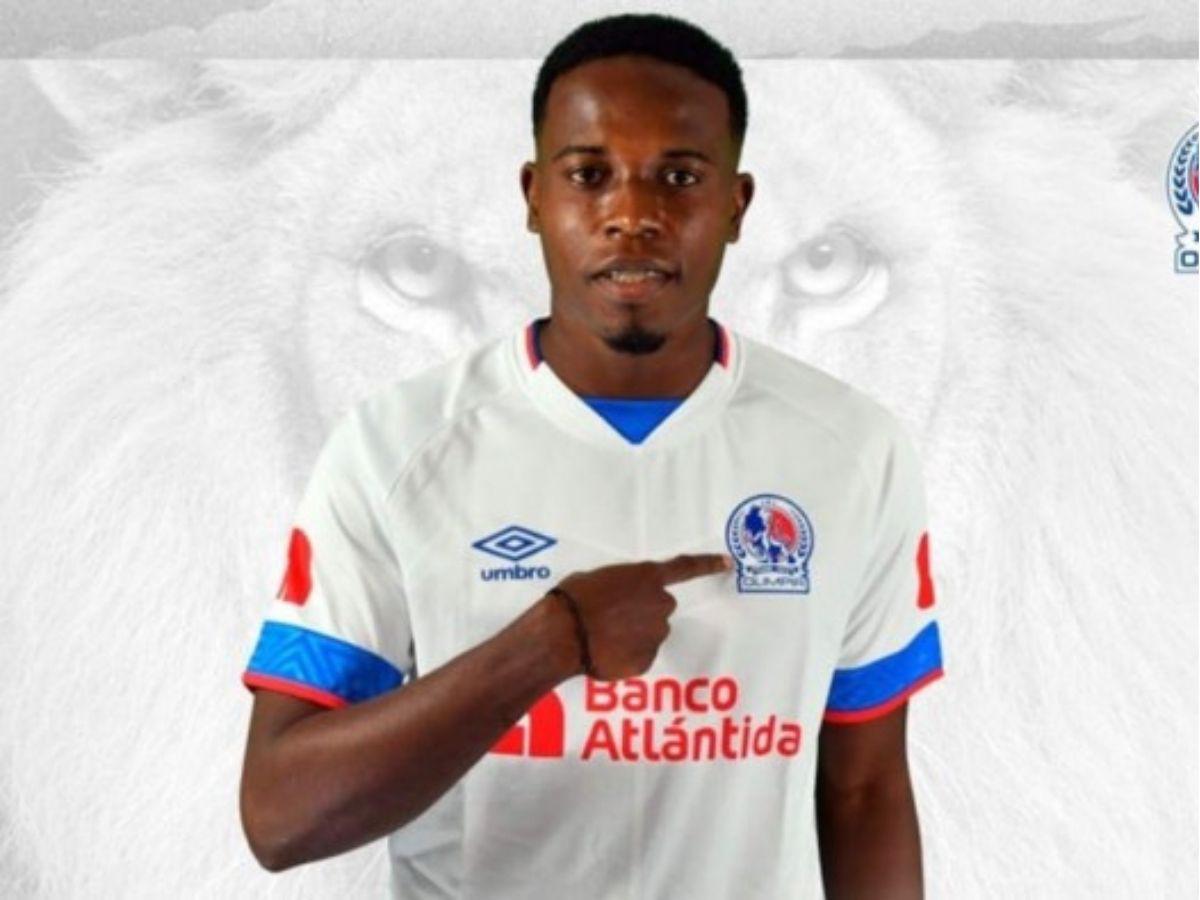 Exfutbolista de Olimpia cuenta su impactante historia: “Psicológicamente me hacían daño”