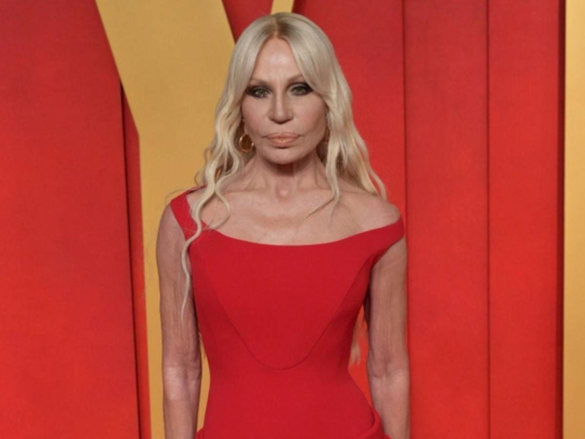 ¿Qué cambios ha hecho Donatella Versace en su rostro? Esto dicen los expertos