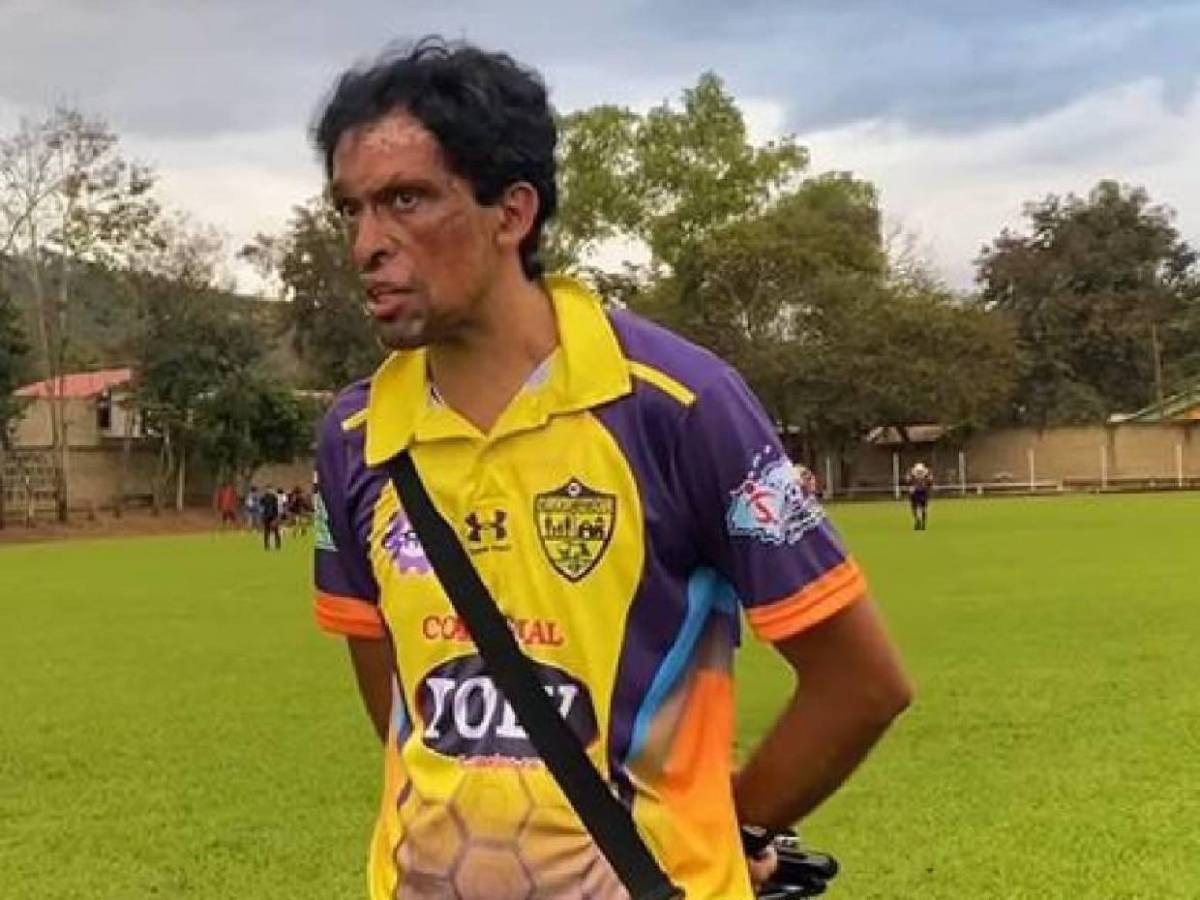 Pedro Joaquín Amador quiere ser convocado a la Selección de Honduras: Las condiciones que puso