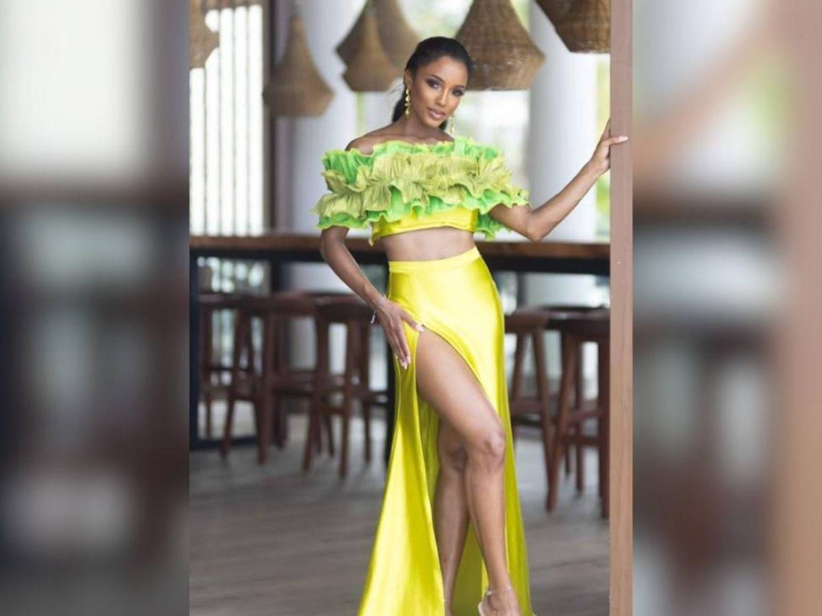 ¿Cuál es el estado de salud de Miss Universo Jamaica? Esto se sabe