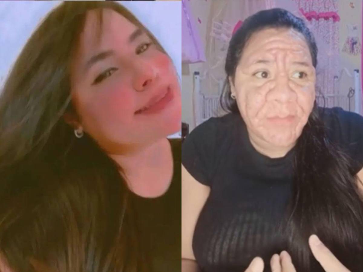 Joven con 8 meses de embarazo enfrenta deformación facial tras error médico