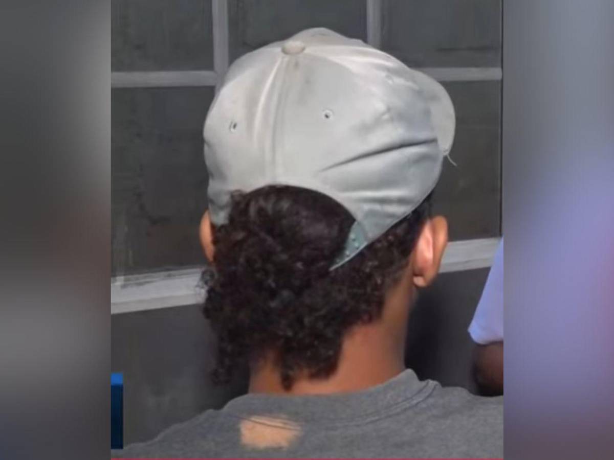 Delivery herido por 'El Burro': Me dijeron que me quedaría con la bala de recuerdo en el Catarino Rivas