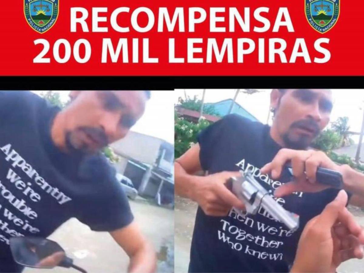 Delivery herido por 'El Burro': Me dijeron que me quedaría con la bala de recuerdo en el Catarino Rivas