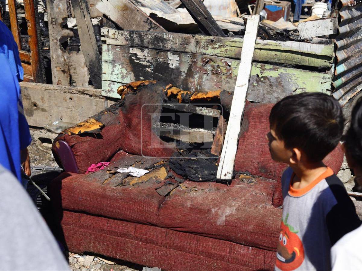 Dios ya lo había salvado: Niño fallecido en incendio en SPS había superado dos cirugías