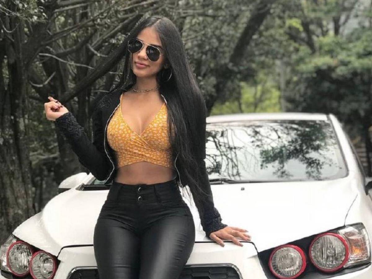 El antes y el después de la modelo Karina García: su transformación total