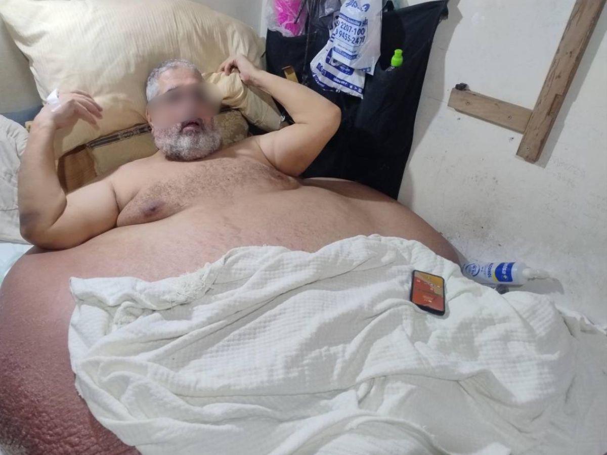 ¿Cómo llegó a pesar 630 libras?: narran la historia de Nasser, “el hombre más obeso de Honduras”