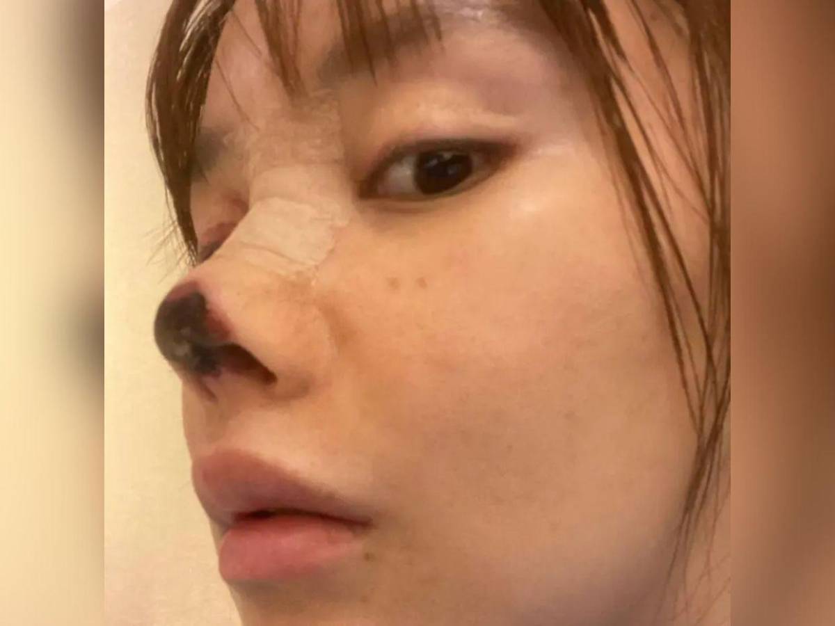 Abby Wu, la mujer que se ha hecho más de 100 cirugías: Nunca dejaré de hacérmelas