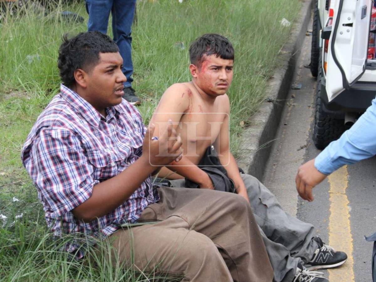 EN FOTOS: Varios heridos, vehículos destruidos y una cisterna volcada deja fuerte accidente en el anillo periférico