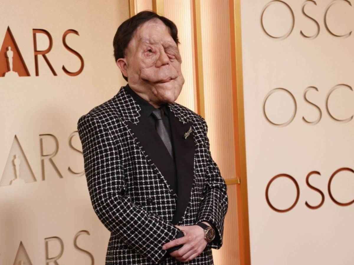 Adam Pearson, el actor con neurofibromatosis que brilló en los Oscar 2026