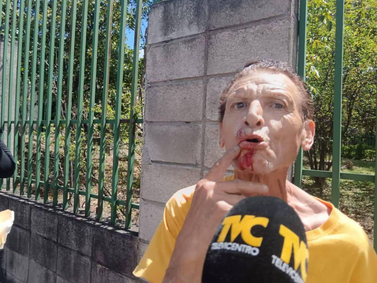 Pasajera armada intenta asaltar a taxista en el bulevar San Juan Bosco, de Tegucigalpa