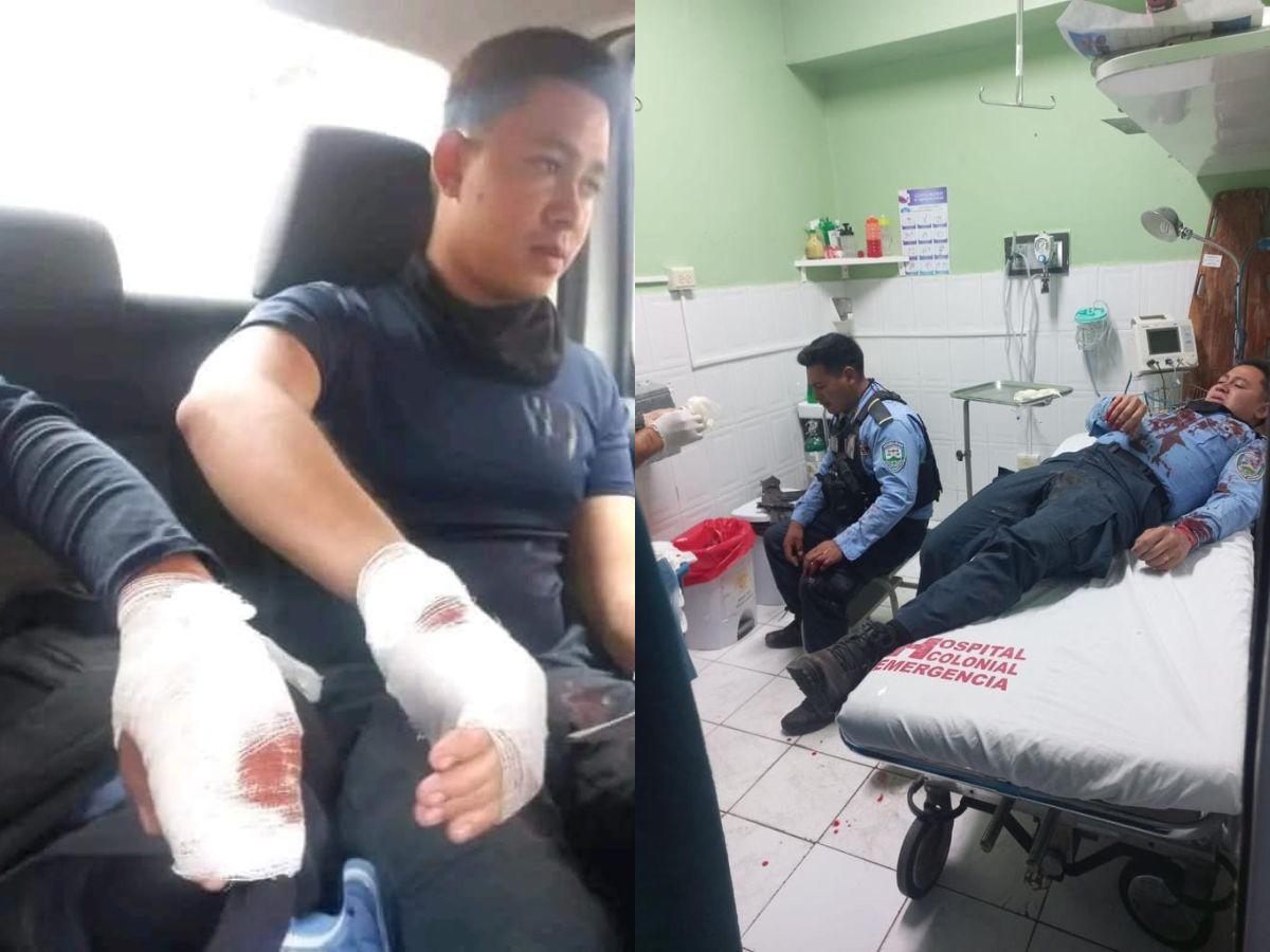 Dos muertos deja enfrentamiento entre policías y ciudadanos en Comayagua