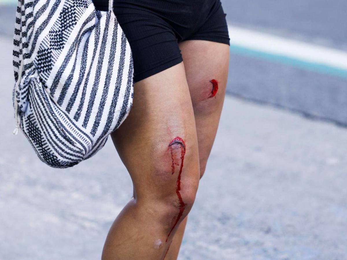 La comunidad de Los Ángeles se resiste a doblegar; siguen protestas