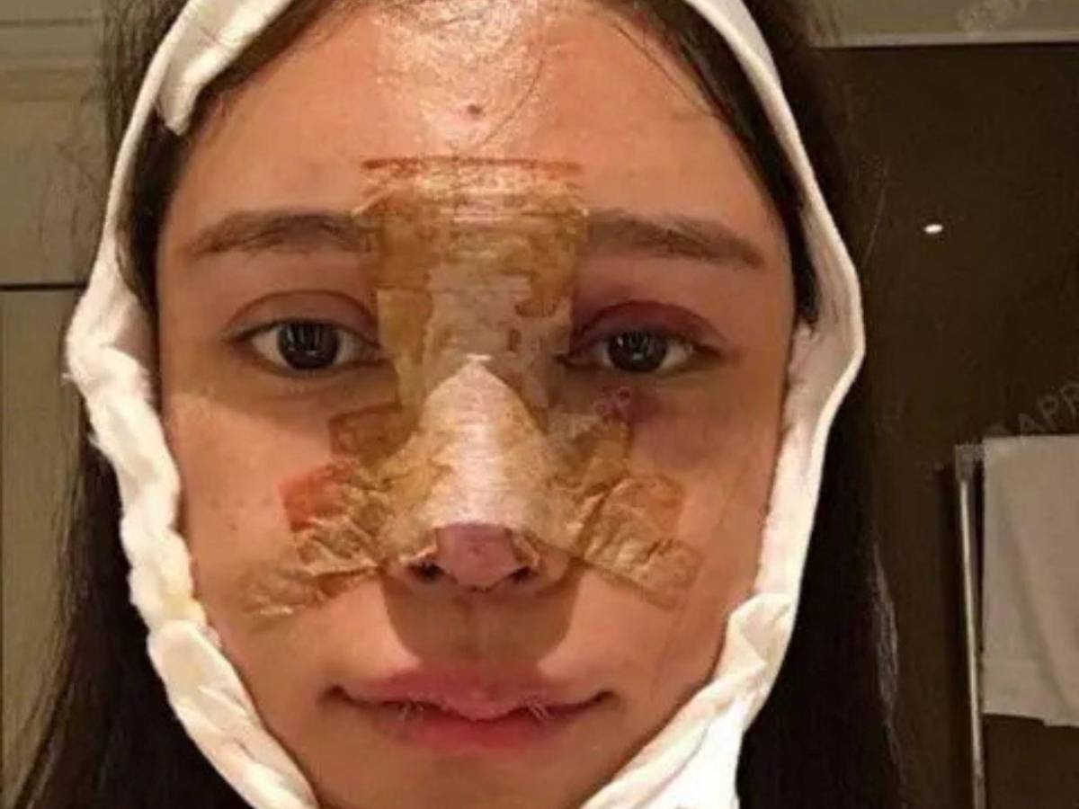 Abby Wu, la mujer que se ha hecho más de 100 cirugías: Nunca dejaré de hacérmelas