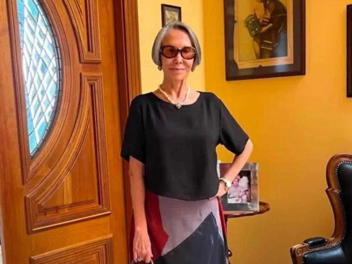 Florinda Meza revela el daño que una cirugía estética le dejó  en el rostro