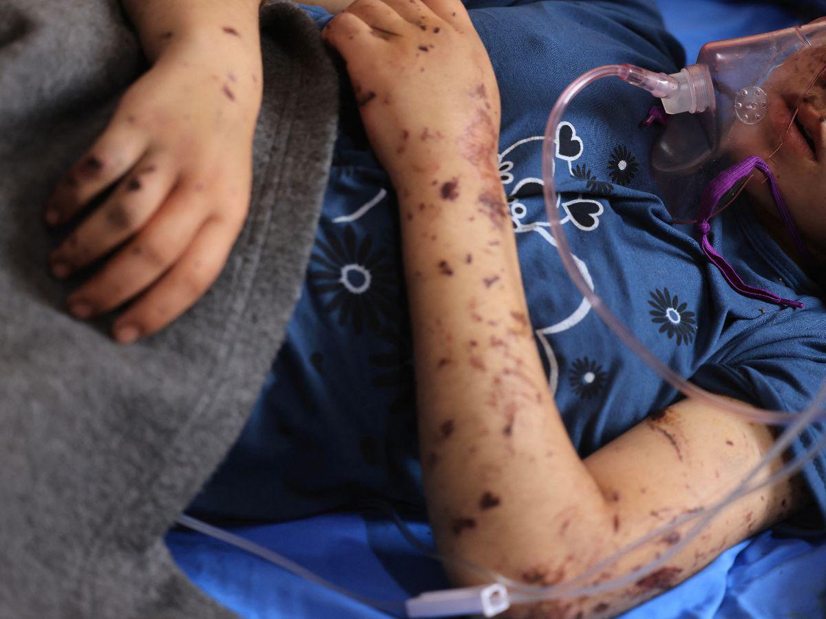 “¡Devuélvanme mis piernas!”, clama niño amputado en la guerra de Gaza