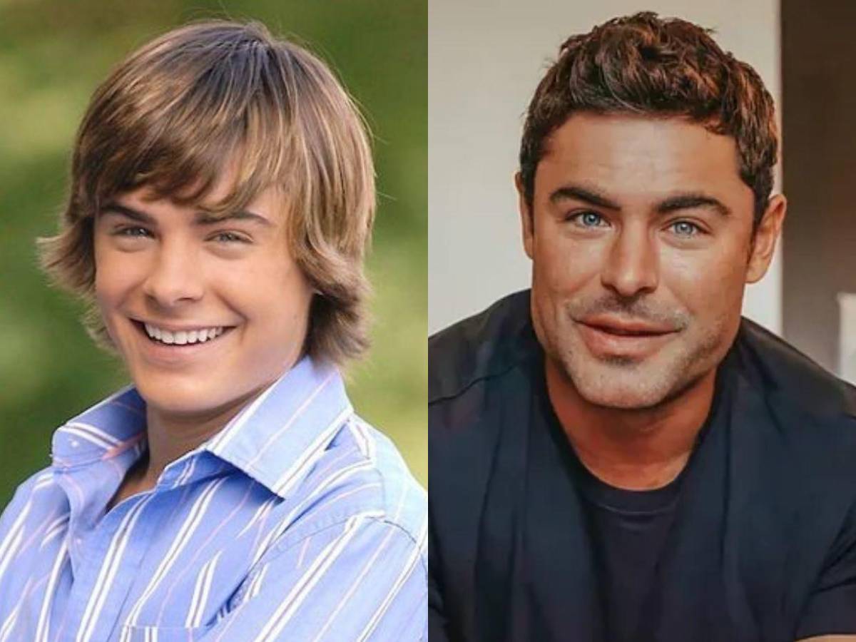 Así fue el accidente que transformó el rostro de Zac Efron
