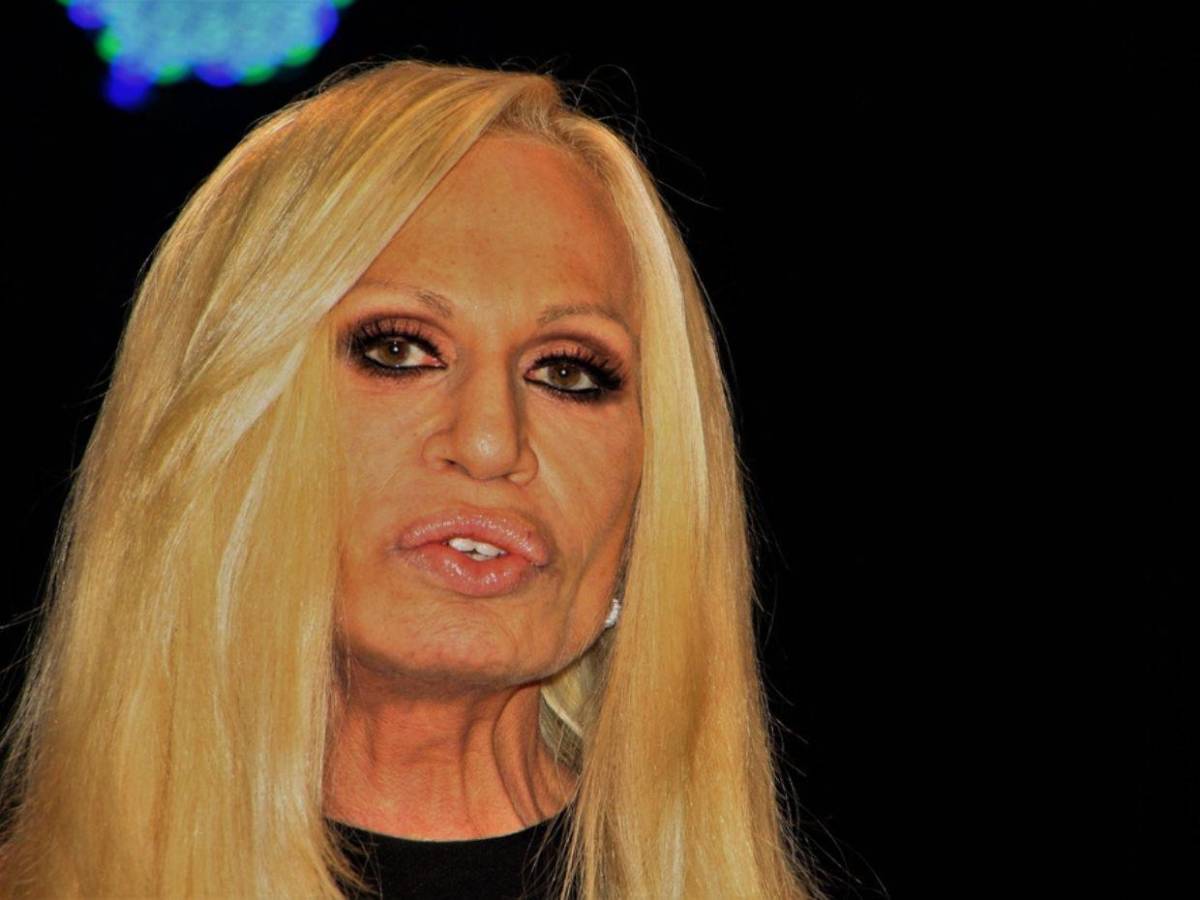 ¿Qué cambios ha hecho Donatella Versace en su rostro? Esto dicen los expertos