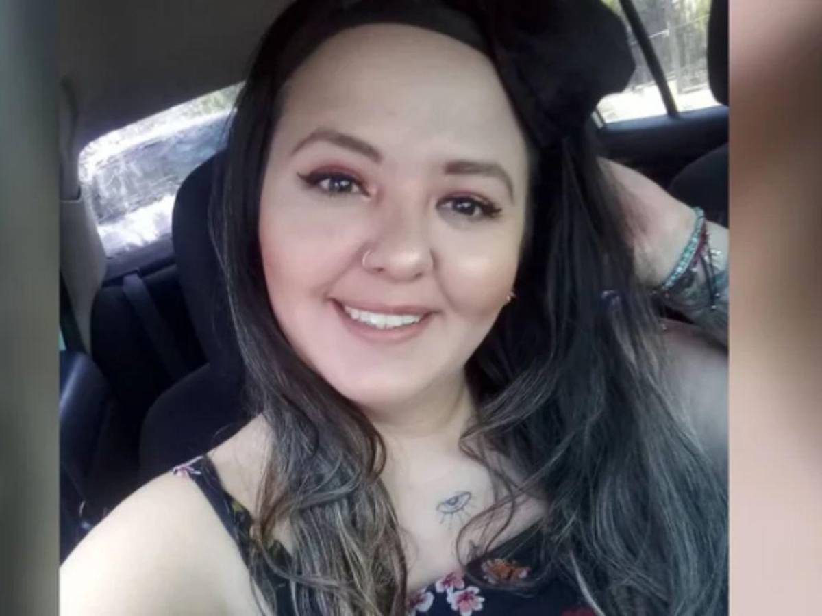 Fiscalía pone en duda hipótesis de homicidio en caso de mujer que murió por quemaduras en México