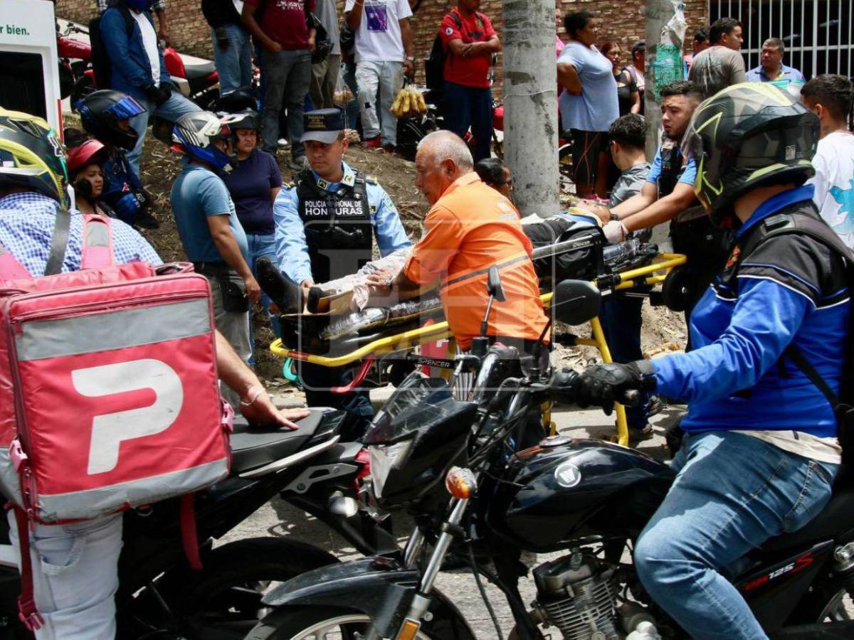Por evitar atropellar una persona: motociclista queda muy herido en accidente en Tegucigalpa
