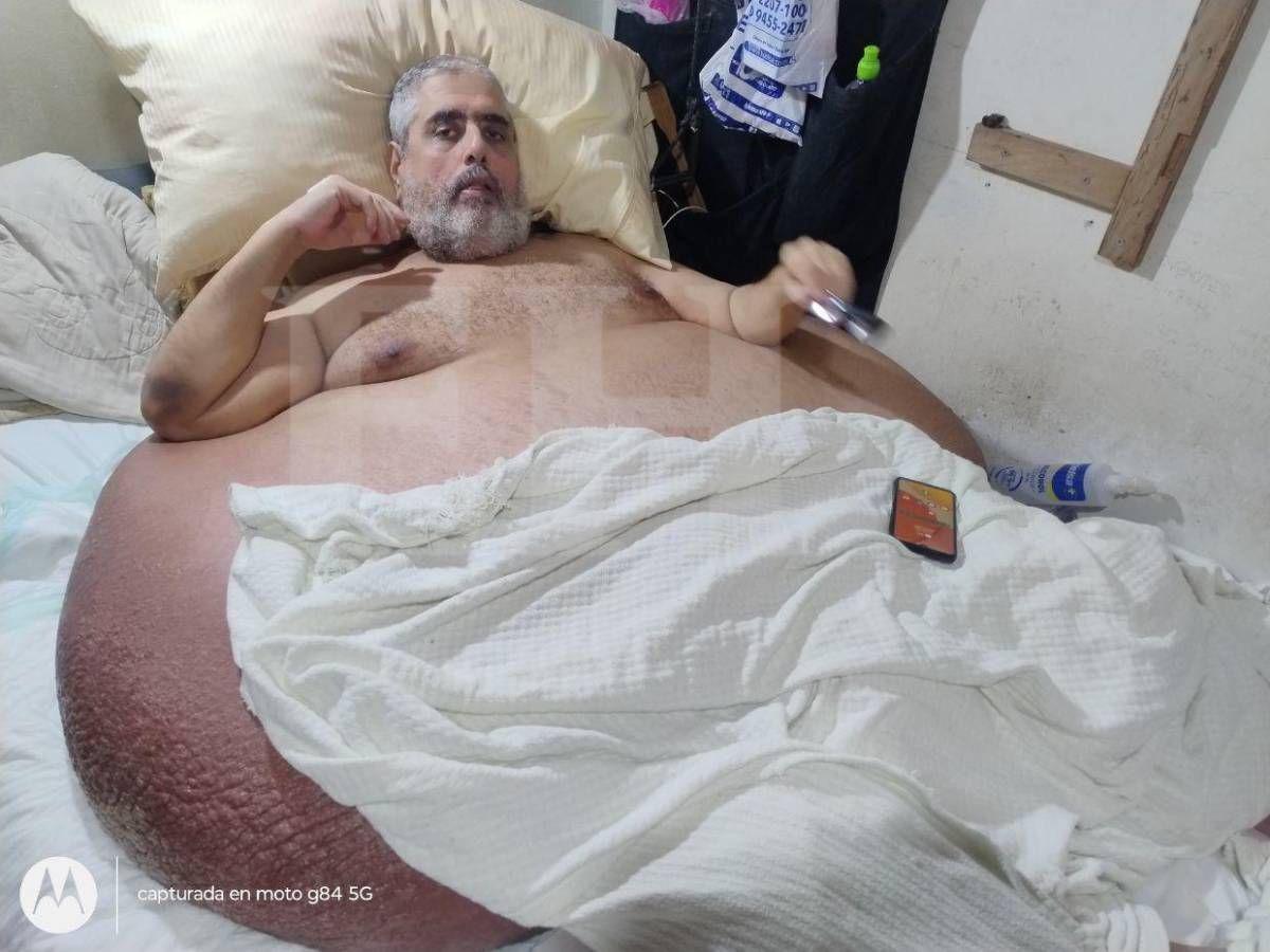 ¿Cómo llegó a pesar 630 libras?: narran la historia de Nasser, “el hombre más obeso de Honduras”